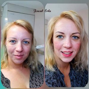 Hybrid kialakítás (a soft powder és a szálas technika ötvözve)