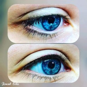 Szempilla sűrítés